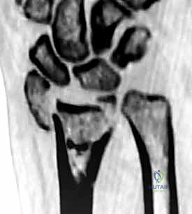 تخطيط ما قبل الجراحة