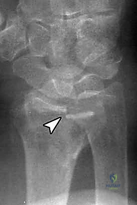 مقارنة العلاجات