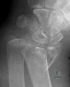 استشارة المريض