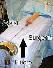 إتقان تثبيت كسور الكعبرة البعيدة بالصفيحة الأمامية: دليل شامل للمرضى مع الأستاذ الدكتور محمد هطيف