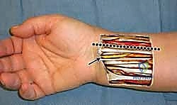 ميكانيكا الصفيحة