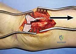 تمارين الأصابع المبكرة
