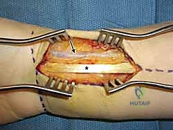 تجهيز غرفة العمليات