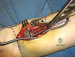 الشفافية الطبية