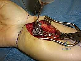 الأستاذ الدكتور محمد هطيف