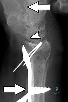 عيادة الدكتور هطيف