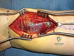 الفحص النهائي بالأشعة