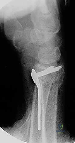 تقييم المخاطر