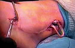 الأستاذ الدكتور محمد هطيف رائد جراحة العظام في اليمن