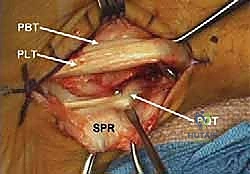 الخيارات العلاجية للكاحل
