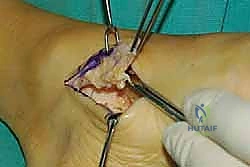 تشريح القدم والكاحل