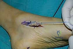 تقييم حالة المريض قبل الجراحة