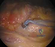 TECH FIG 3 continued C