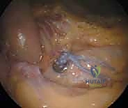 TECH FIG 3 continued C