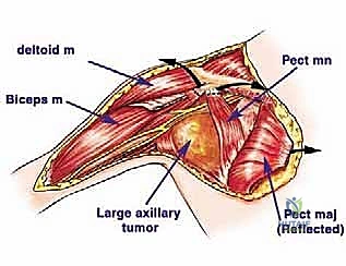 ترميم الأنسجة وإغلاق الجرح