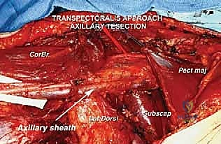متابعة المريض في غرفة الإفاقة