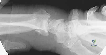 تجهيز مواضع البراغي