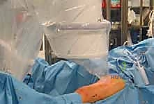 كيفية تشخيص كسور الفخذ لدى الأطفال بالأشعة