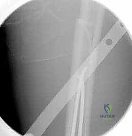 التحضير قبل عملية تثبيت كسور الفخذ