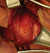 التشريح المعقد لمفصل القص الترقوي