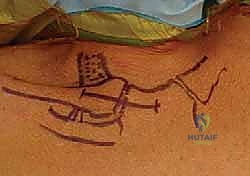 أعراض وتورم في منطقة مفصل القص الترقوي