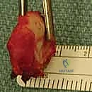 استعادة نطاق الحركة تدريجياً