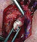 تمارين العلاج الطبيعي بعد الجراحة