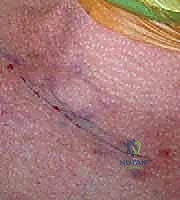 Clinical Image