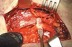 استخدام جهاز الأشعة المرئية C-arm أثناء الجراحة لضمان الدقة