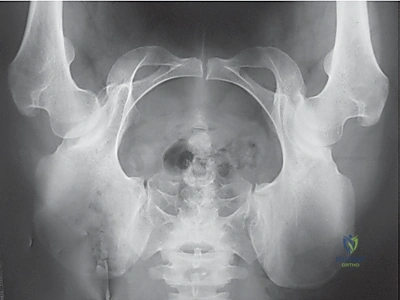 الأستاذ الدكتور محمد هطيف أثناء التخطيط الجراحي