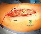 التأكد من مسار السلك الدليلي