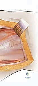 تعديل الزاوية بعد القطع