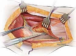 التأكد من متانة التثبيت الداخلي