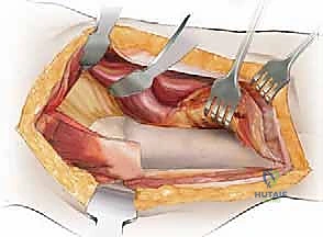 استخدام البرمجيات المتقدمة في التخطيط الجراحي