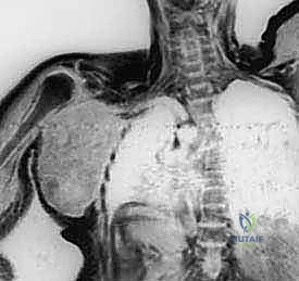 تحضير المريض في غرفة العمليات