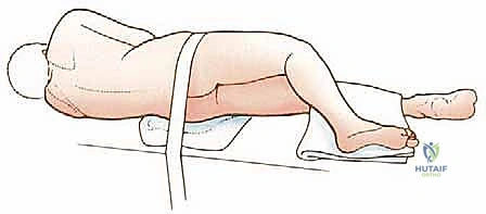 إزالة الطرف والورم ككتلة واحدة