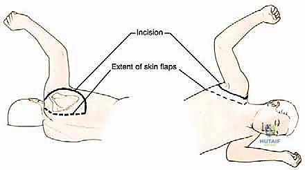 مراقبة المريض في العناية المركزة