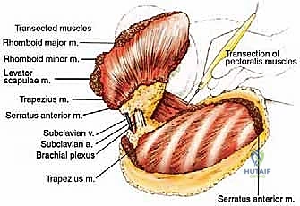 صورة توضيحية لـ استئصال الربع الأمامي: دليل شامل للمرضى مع الأستاذ الدكتور محمد هطيف
