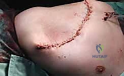 Clinical Image