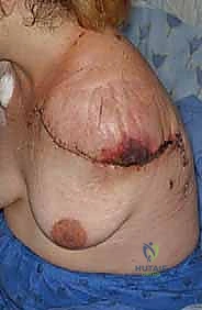 Clinical Image