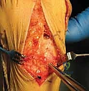 الأستاذ الدكتور محمد هطيف في غرفة العمليات المجهزة بأحدث التقنيات