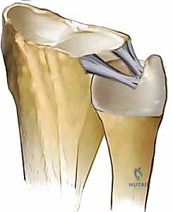 الكعبرة تدور حول رأس الزند عبر المفصل الزندي الكعبري البعيد
