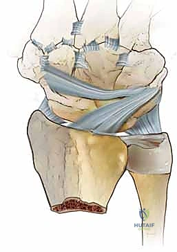 المفصل الزندي الكعبري البعيد مستقر بفضل التوافق العظمي والأربطة