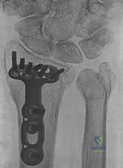 استخدام الأشعة السينية في التشخيص