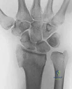 التخطيط المسبق للعملية الجراحية