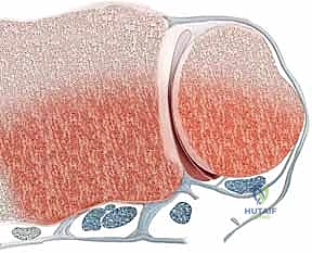 صورة طبية: علاج كسور عظم الزند: دليل شامل لكسور الناتئ الإبري، الرأس، والجزء الكردوسي الكردوسي مع الأستاذ الدكتور محمد هطيف في صنعاء