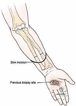 العلاج الطبيعي وإعادة التأهيل