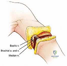 الرعاية الشاملة مع د. محمد هطيف