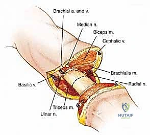 بتر الأطراف العلوية في علاج الأورام السرطانية: دليل شامل للمرضى مع الأستاذ الدكتور محمد هطيف