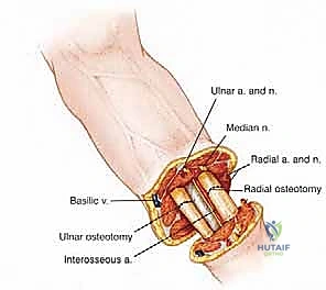 تشريح الطرف العلوي والأورام - د. محمد هطيف
